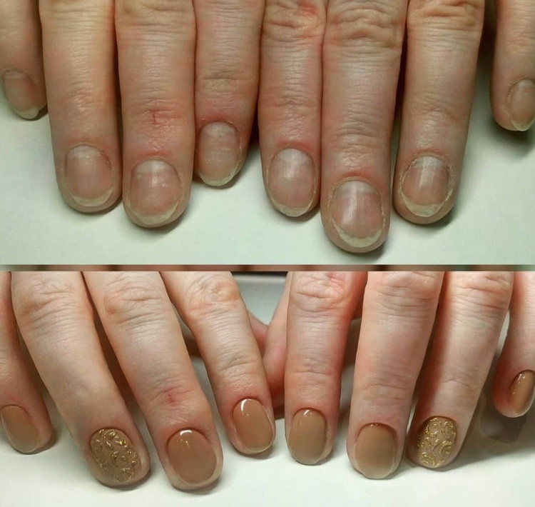 обгрызанные ногти до и после маникюра