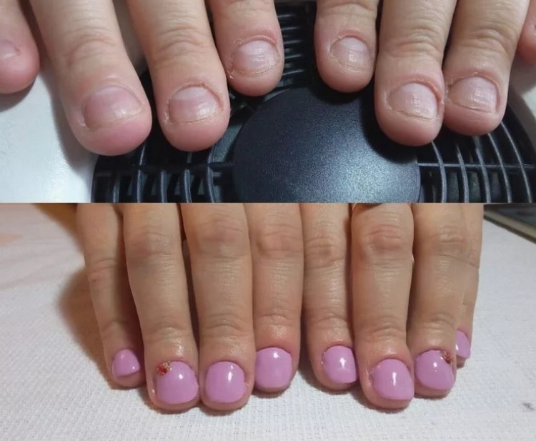 маникюр на короткие обгрызанные ногти до и после